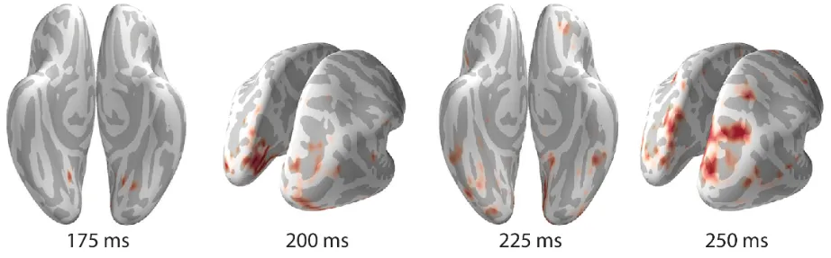 Neuroimaging.PNG
